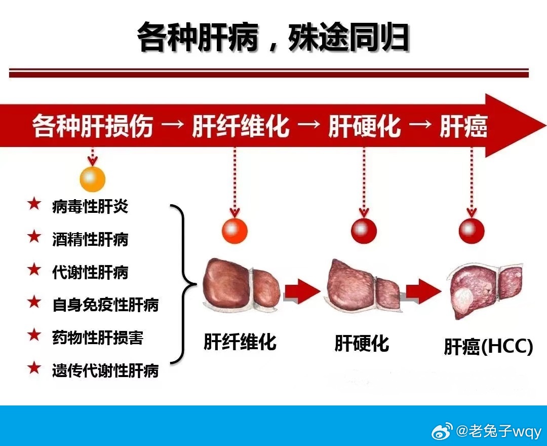 肝病最新疗法及其步骤指南简介